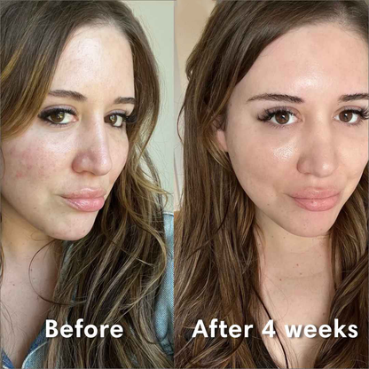 GlowRevive BioCollagen Droommasker