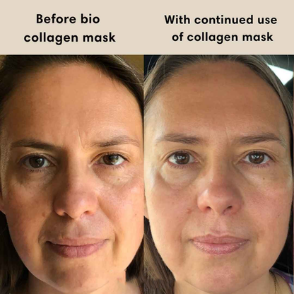 GlowRevive BioCollagen Droommasker